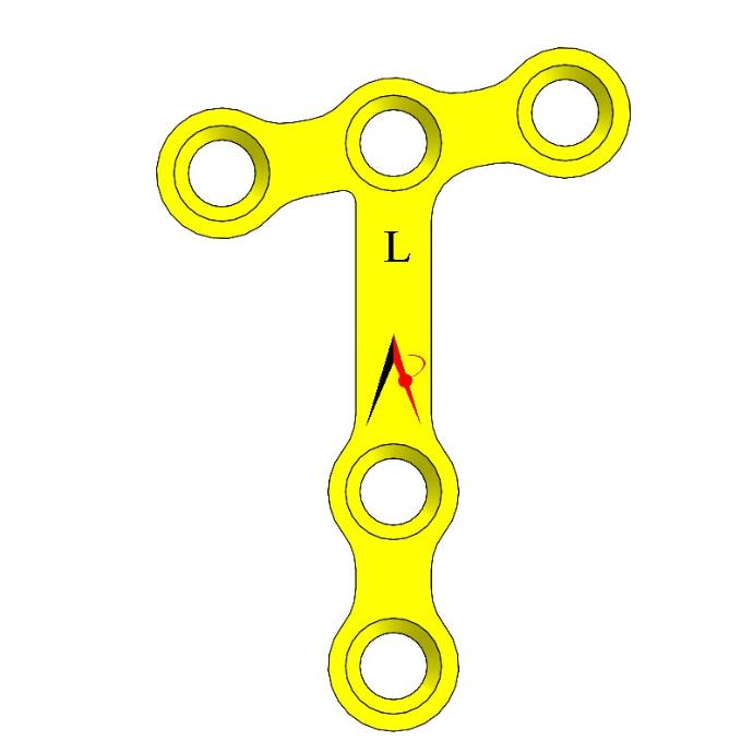 MINI PLATE T ANGLE RIGTH & LEFT (1.0mm)